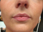 Before image for Sarah