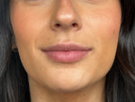 Before image for Ellie